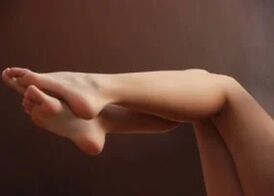 Women's legs do not have varicose veins